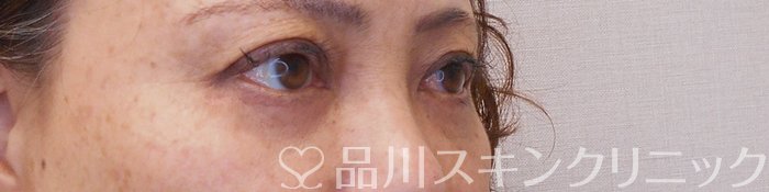症例NO.70129のAFTER写真