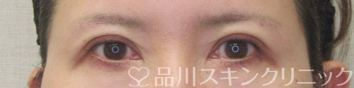 症例NO.71138のAFTER写真
