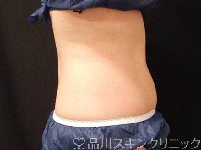 症例NO.69367のBEFORE写真