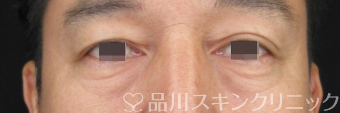 症例NO.63724のBEFORE写真