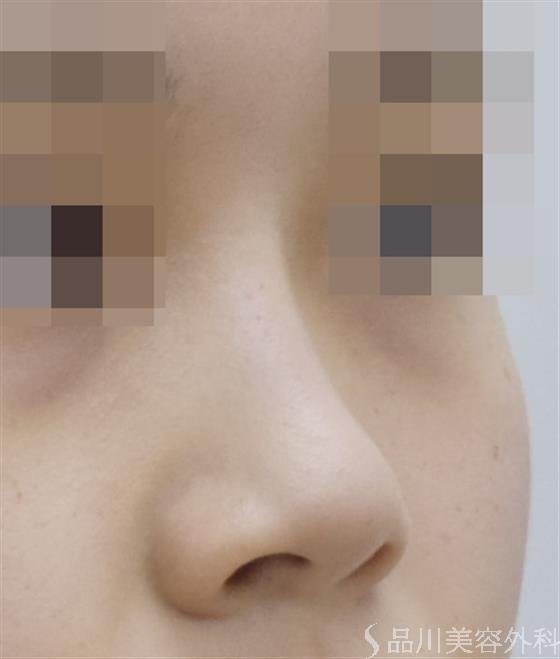 症例NO.47631のBEFORE写真