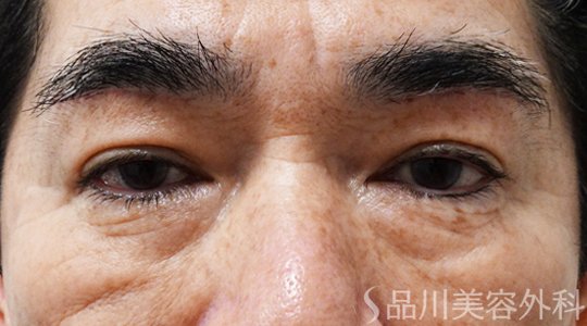 症例NO.69799のAFTER写真
