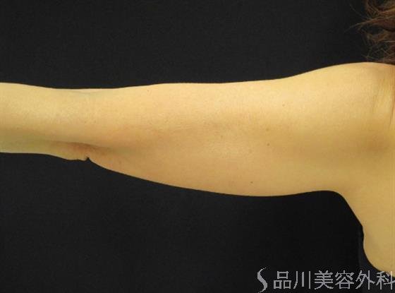 症例NO.50806のBEFORE写真