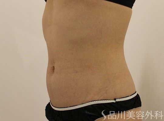 症例NO.73376のBEFORE写真