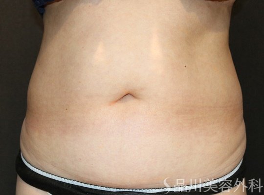 症例NO.73692のBEFORE写真