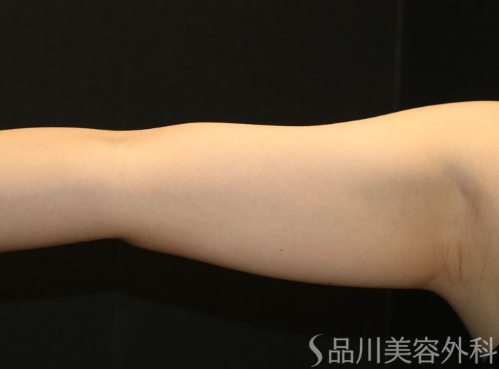 症例NO.71629のBEFORE写真