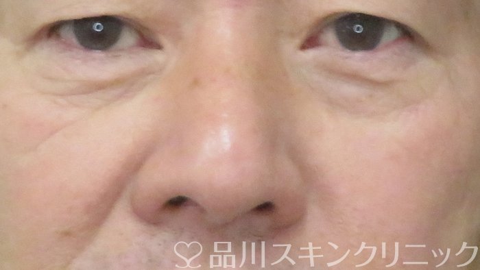 症例NO.71641のBEFORE写真