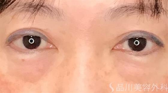 症例NO.59626のBEFORE写真