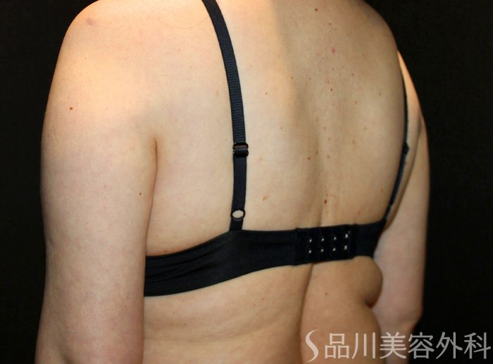 症例NO.73850のBEFORE写真