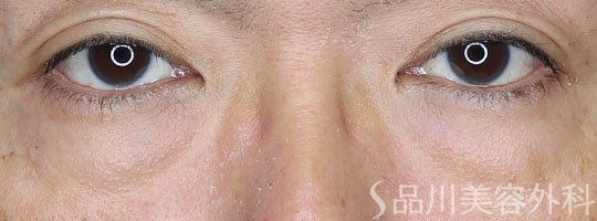 症例NO.65302のBEFORE写真