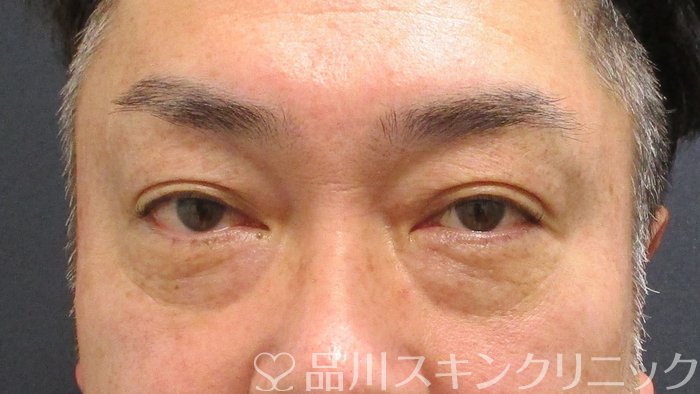 症例NO.63302のBEFORE写真