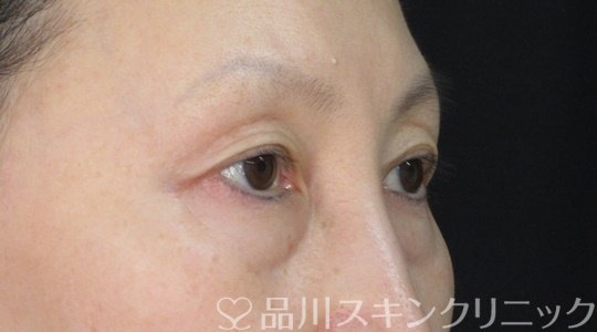 症例NO.72027のBEFORE写真