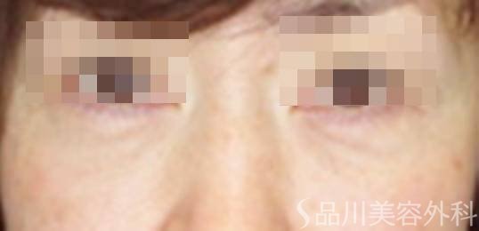 症例NO.73775のAFTER写真