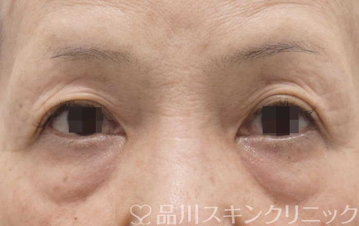症例NO.73944のBEFORE写真