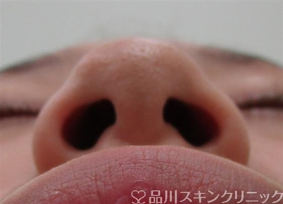 症例NO.31981のBEFORE写真