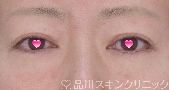 症例NO.65098のBEFORE写真