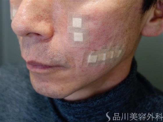症例NO.49784のAFTER写真