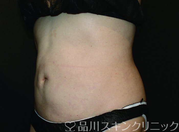 症例NO.69686のBEFORE写真