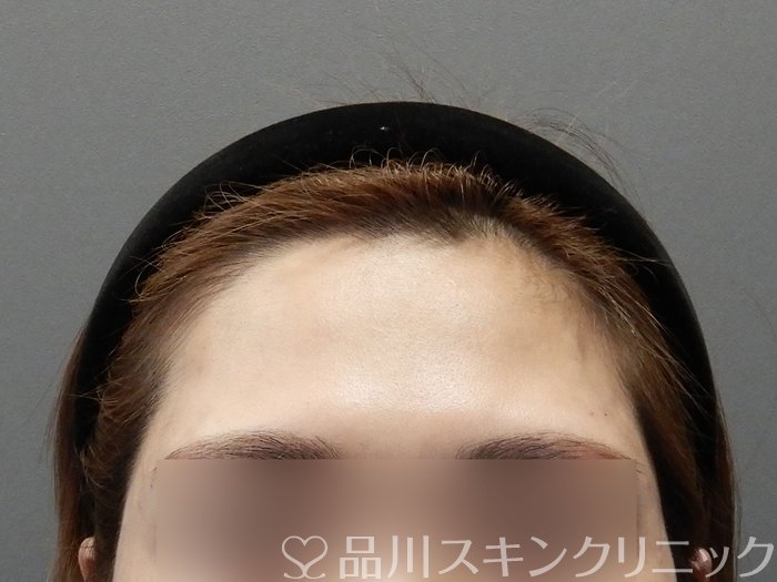 症例NO.73207のAFTER写真