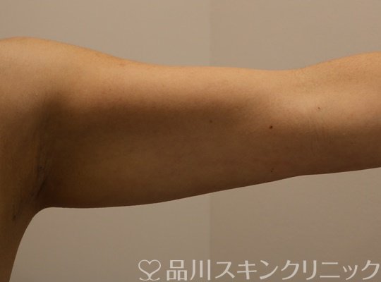 症例NO.72154のBEFORE写真