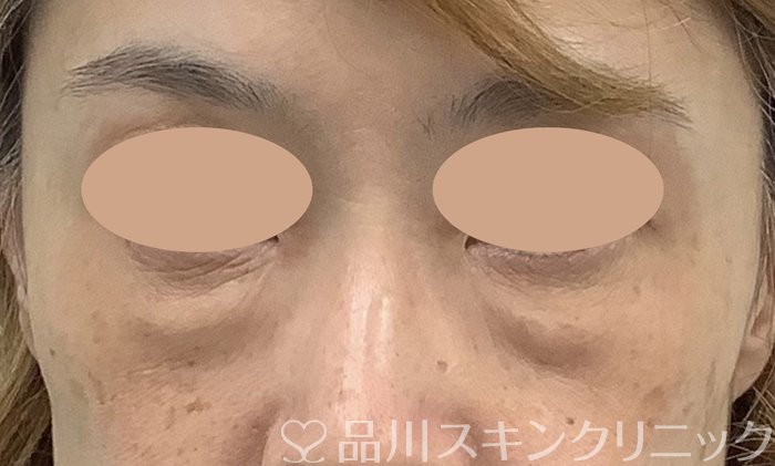 症例NO.73859のBEFORE写真