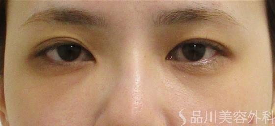 症例NO.60132のAFTER写真