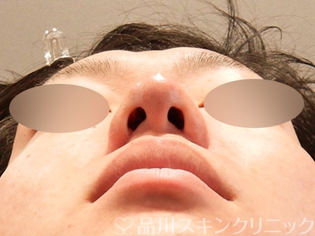 症例NO.70282のAFTER写真