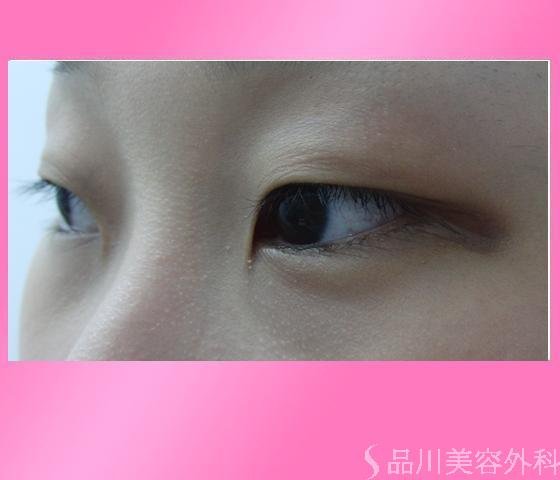 症例NO.7134のBEFORE写真