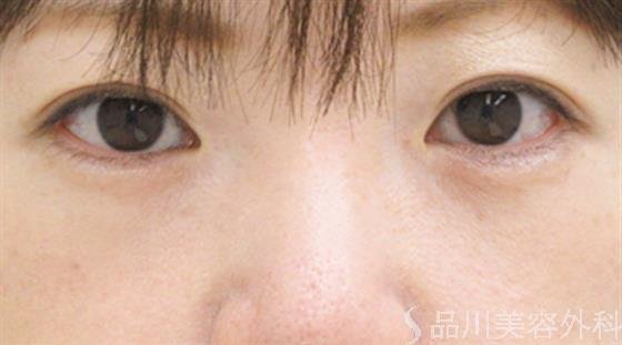 症例NO.22977のAFTER写真