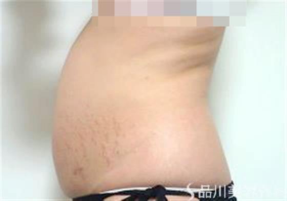 症例NO.21738のBEFORE写真