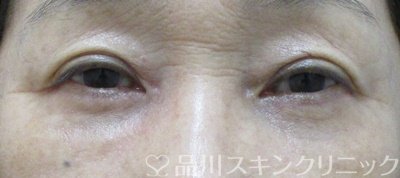 症例NO.71789のAFTER写真
