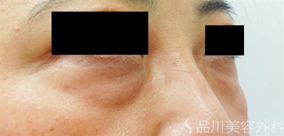 症例NO.39676のBEFORE写真