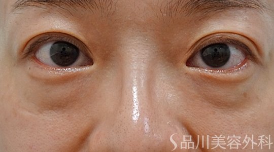 症例NO.73656のBEFORE写真