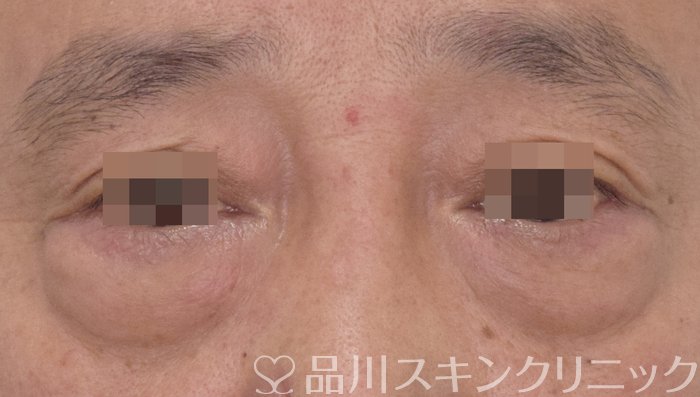 症例NO.70793のBEFORE写真