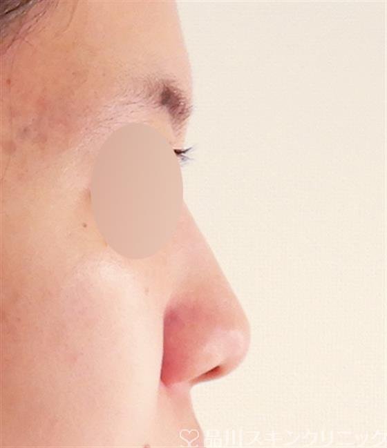 症例NO.60293のBEFORE写真