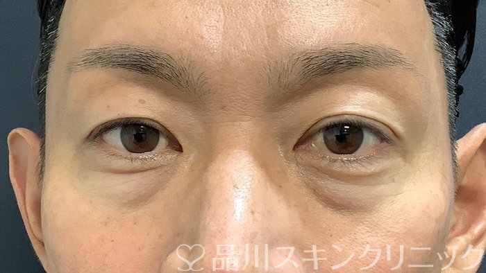 症例NO.64265のBEFORE写真