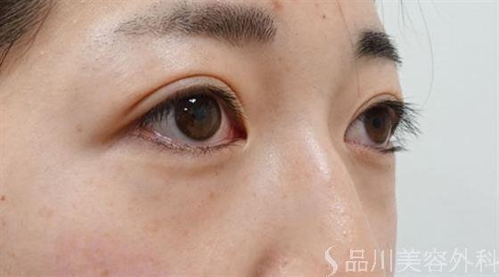 症例NO.50762のBEFORE写真