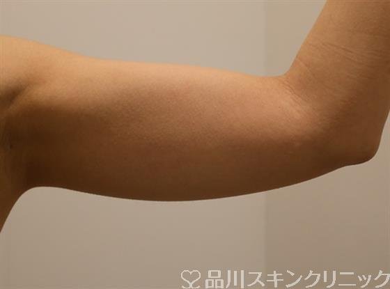 症例NO.40738のBEFORE写真