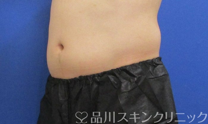 症例NO.70460のBEFORE写真