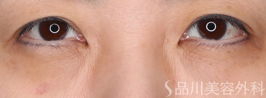 症例NO.73906のBEFORE写真