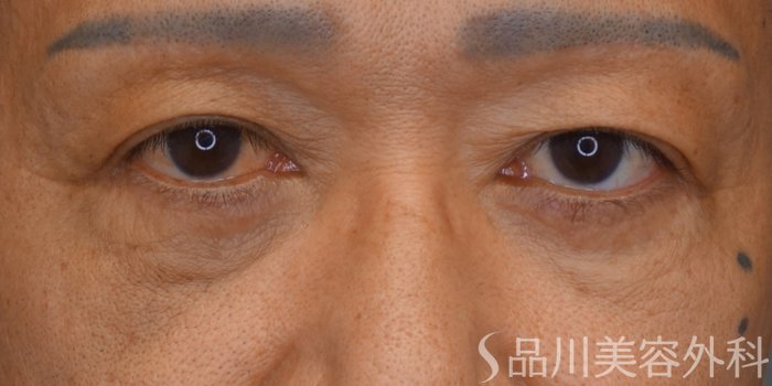 症例NO.73452のBEFORE写真