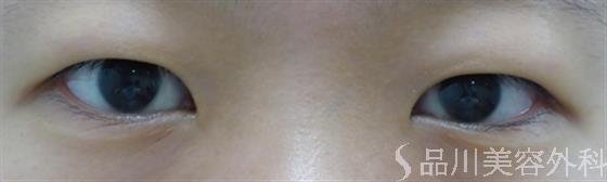 症例NO.27899のBEFORE写真