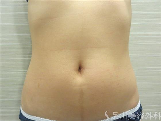 症例NO.21583のBEFORE写真