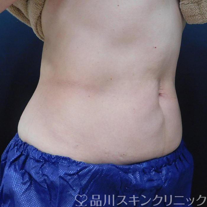 症例NO.65639のAFTER写真
