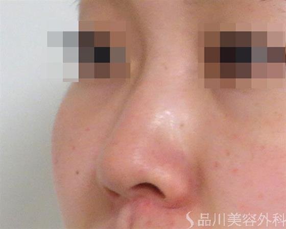 症例NO.36286のBEFORE写真