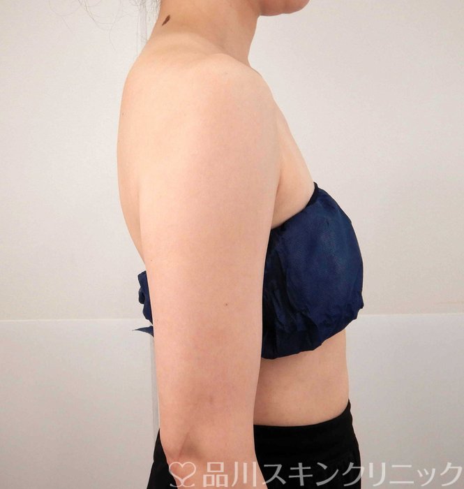 症例NO.62189のBEFORE写真