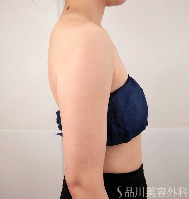 症例NO.62189のBEFORE写真