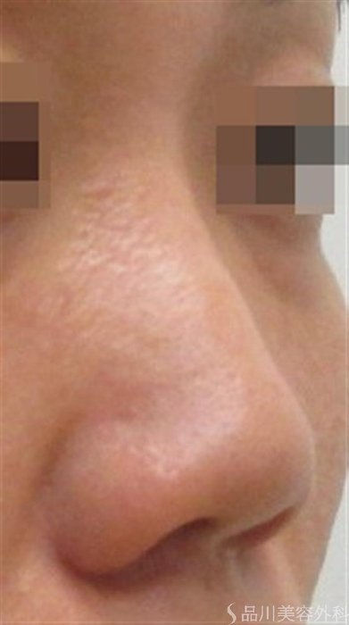 症例NO.19202のBEFORE写真