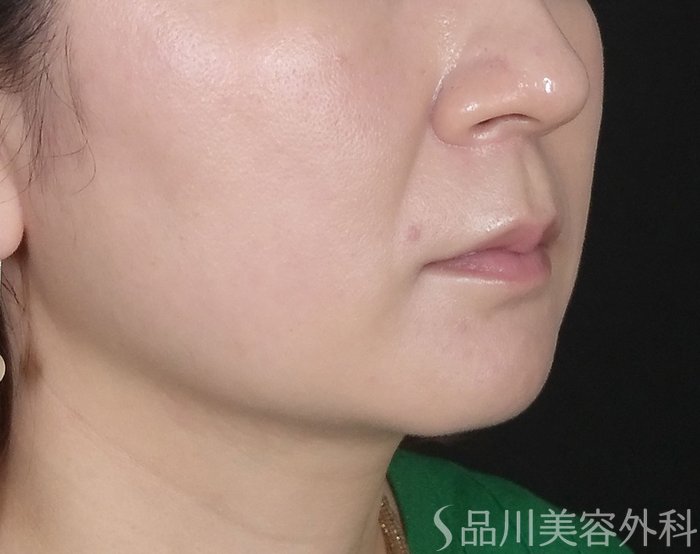 コストを削減する方法はありますか?