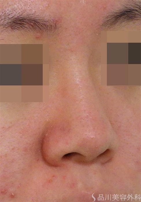 症例NO.40038のBEFORE写真